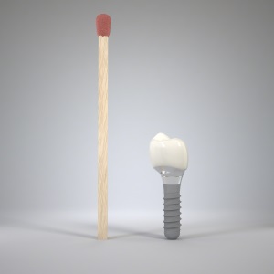 Materiales de los implantes dentales en Clínica Dental Díez - tu dentista de confianza en Madrid Legazpi